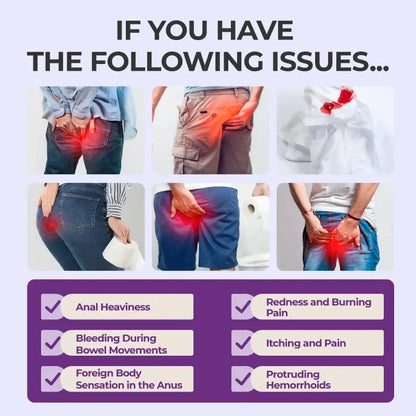Hemorrhoid Gel Carthamus Seed Scutellaria Baicalensis Extract Carboxymethylcellulose Purple Daisy Apply to the Skin Used for Eliminating Hemorrhoids