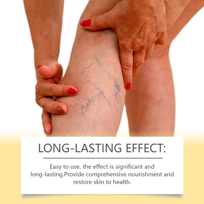 Bee Venom Extract Varicose Veins Cream, Pain & Swelling Relief Body Lotion, 100g Moisturizer