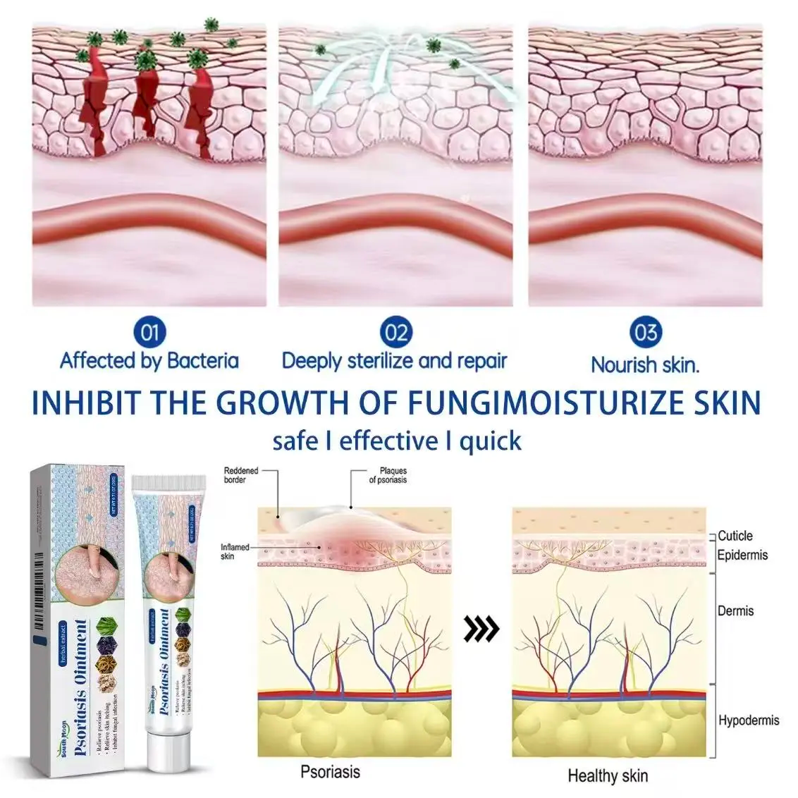 Soothing Antifungal Cream: Fast-Acting Jock Itch & Ringworm Treatment.