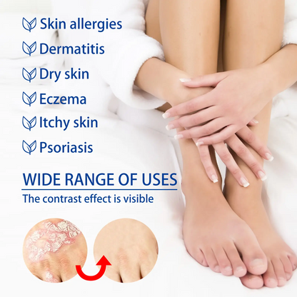 Sensitive Skin Soothing Care Cream, Natural Botanical Formula, Helps Soothe Dryness, Itching and Redness, Suitable for Daily Sensitive Skin Care, Scalp Care and Skin Moisturizing Repair, Deep Hydration